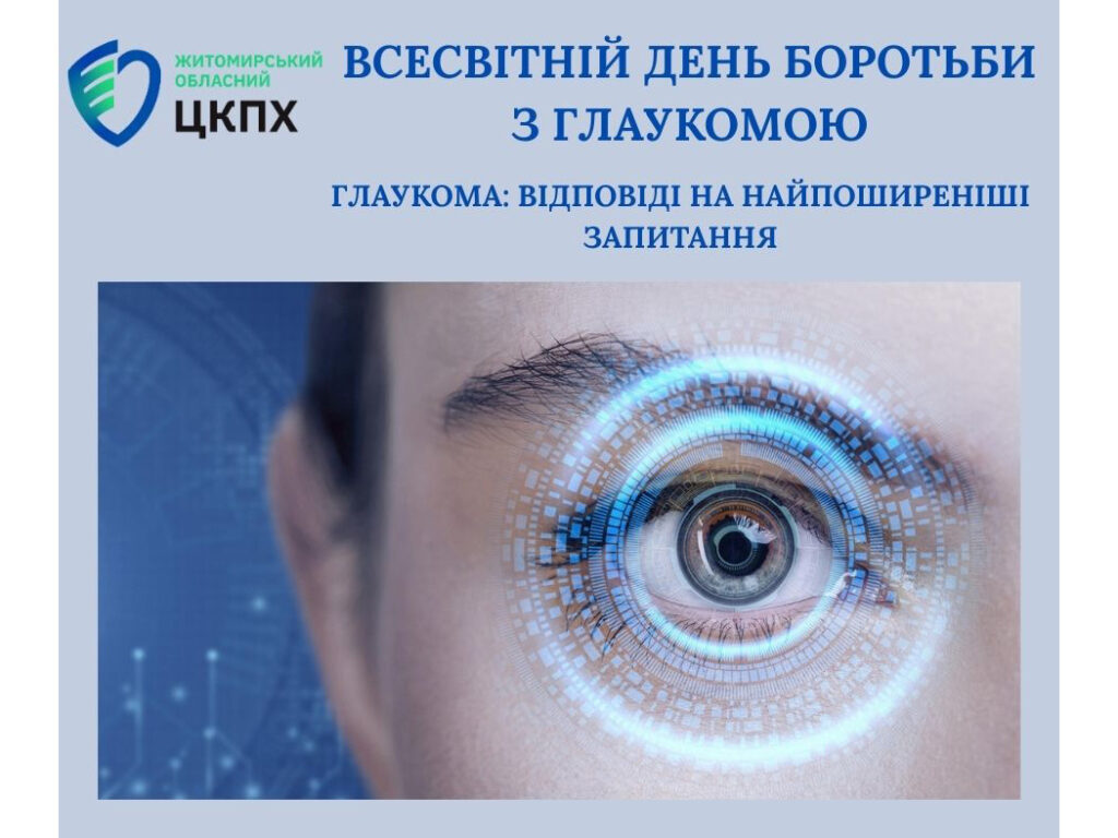 Глаукома: відповіді на найпоширеніші запитання